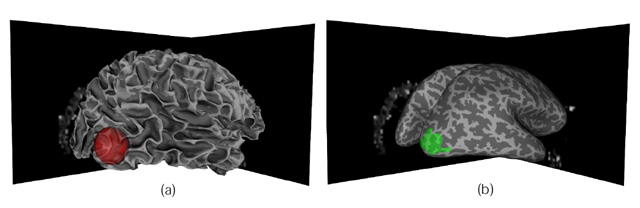 Constraining VOI motion to the 
cortical surface.